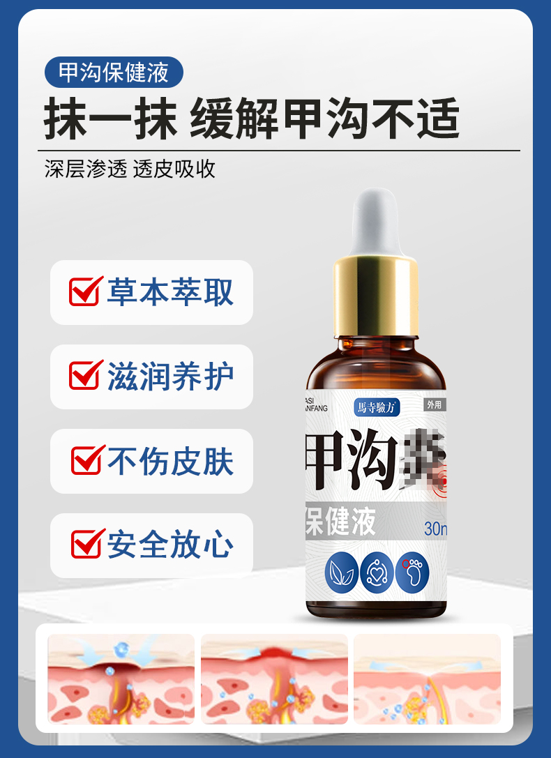 抹一抹，緩解甲溝不適